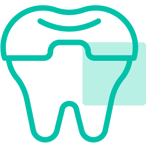 Restauraciones Dentales